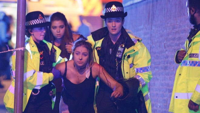 A young girl injured at the Ariana Grande concert on May 22, 2017, is helped by medics outside the Manchester Arena.