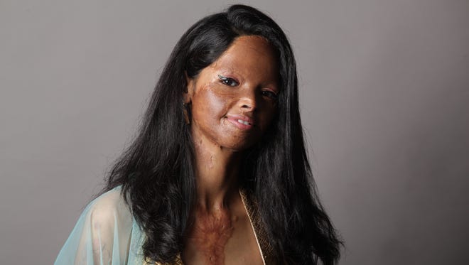 Laxmi Agarwal is an acid attack survivor and is an inspiration for many women.